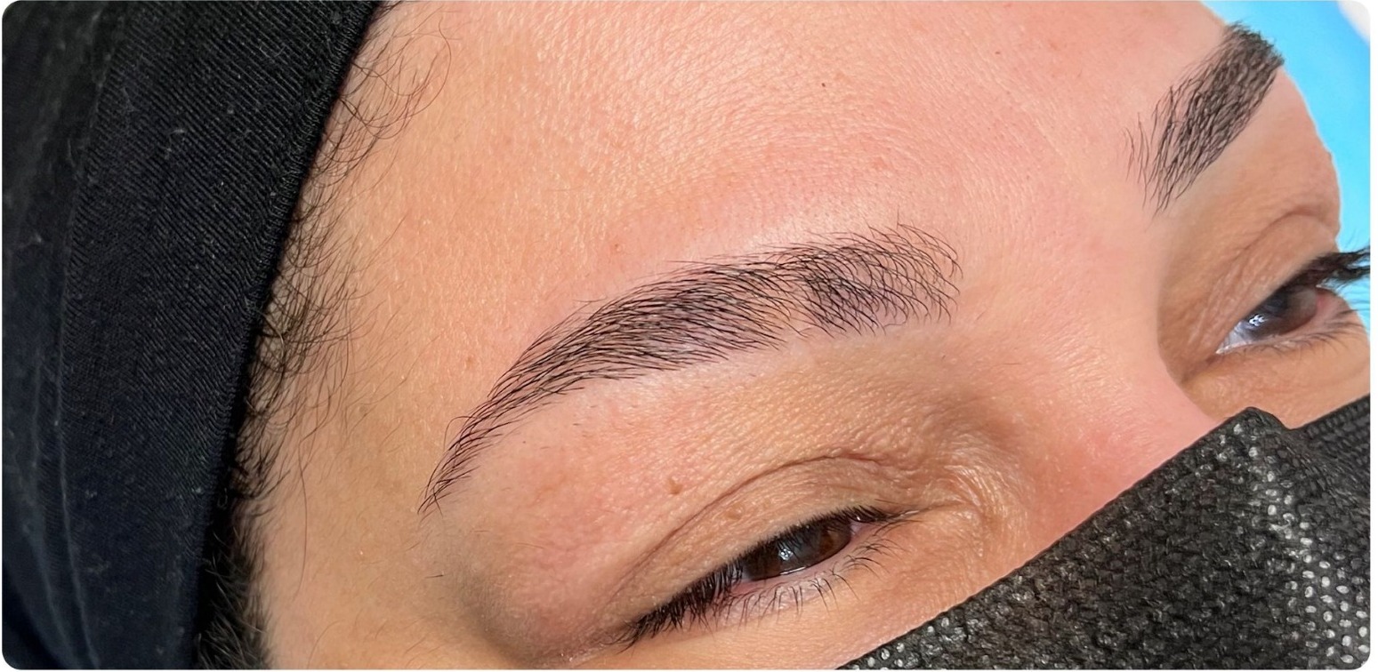 Before image